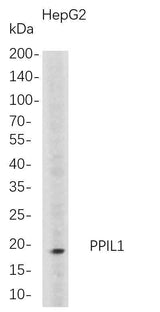 Anti-Human PPIL1 Antibody [B705]