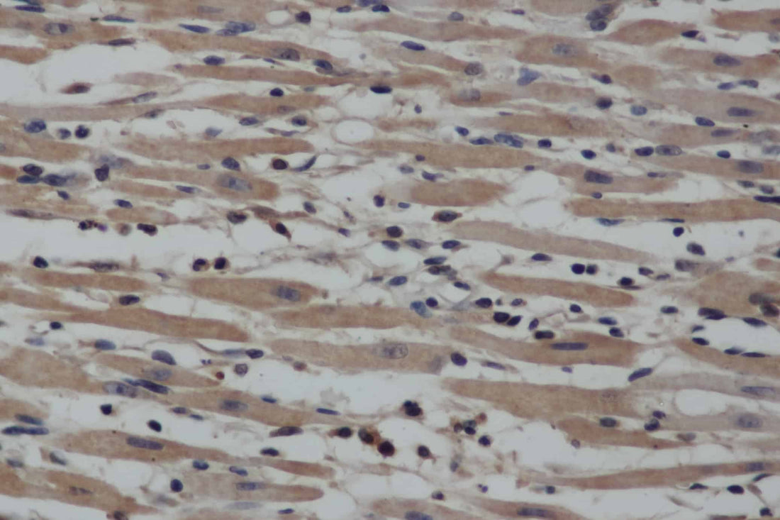 Anti-Human NOS2 Antibody - ABMIUM