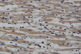 Anti-Human NOS2 Antibody - ABMIUM