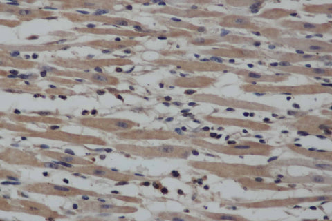 Anti-Human NOS2 Antibody - ABMIUM