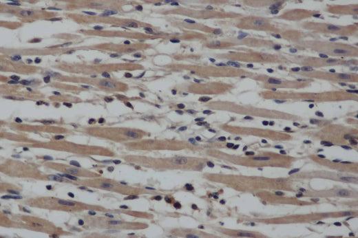 Anti-Human NOS2 Antibody - ABMIUM