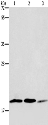 Anti-Human/Mouse/Rat RAP1B Antibody - ABMIUM