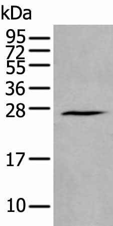 Anti-Human/Mouse/Rat HAND1 Antibody
