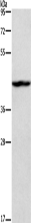 Anti-Human/Mouse TBX20 Antibody - ABMIUM