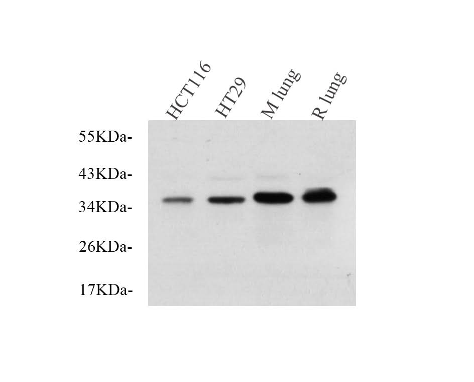 Western Blot analysis of various samples using EpCAM Polyclonal Antibody at dilution of 1:750.