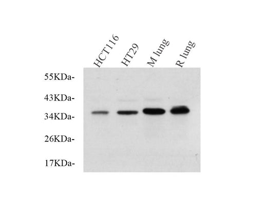 Western Blot analysis of various samples using EpCAM Polyclonal Antibody at dilution of 1:750.