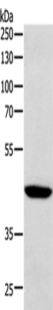Anti-Human/Mouse SOX7 Antibody - ABMIUM