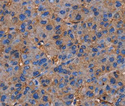 Anti-Human/Mouse NRIP3 Antibody
