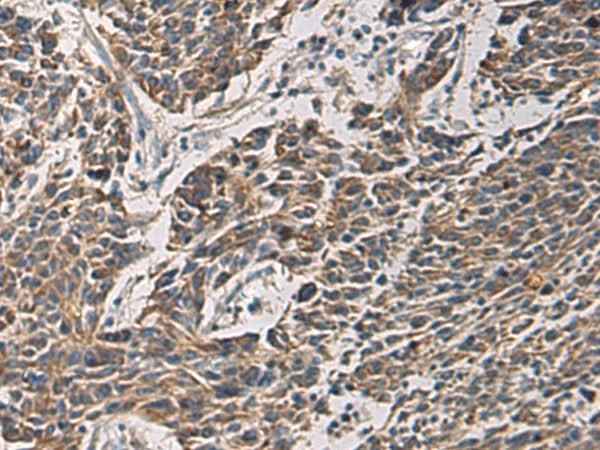 Anti-Human/Mouse/Rat MAPKAPK3 Antibody
