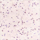 Anti-Human SOX11 Antibody [A364]