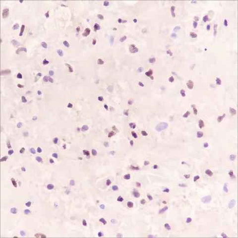 Anti-Human SOX11 Antibody [A364] - ABMIUM