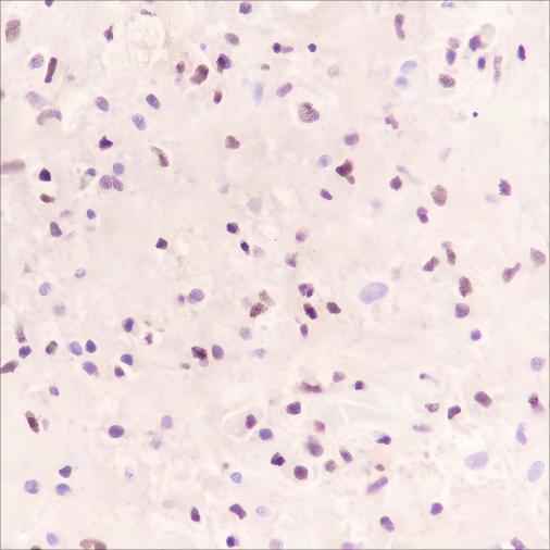 Anti-Human SOX11 Antibody [A364] - ABMIUM
