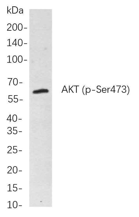 Anti-Human/Mouse/Rat Akt Antibody [B862] - ABMIUM
