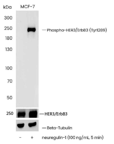 Anti-Human ERBB3 Antibody [A1130] - ABMIUM