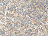 Immunohistochemistry of paraffin-embedded Human tonsil tissue using PPP1R3C Polyclonal Antibody at dilution of 1:50(×200)