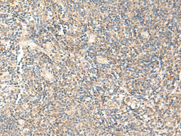 Immunohistochemistry of paraffin-embedded Human tonsil tissue using PPP1R3C Polyclonal Antibody at dilution of 1:50(×200)