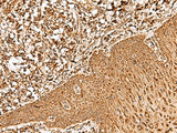 Anti-Human FAM200A Antibody - ABMIUM