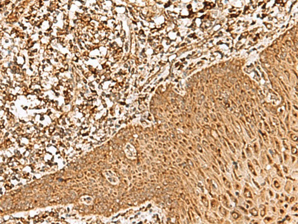 Anti-Human FAM200A Antibody - ABMIUM