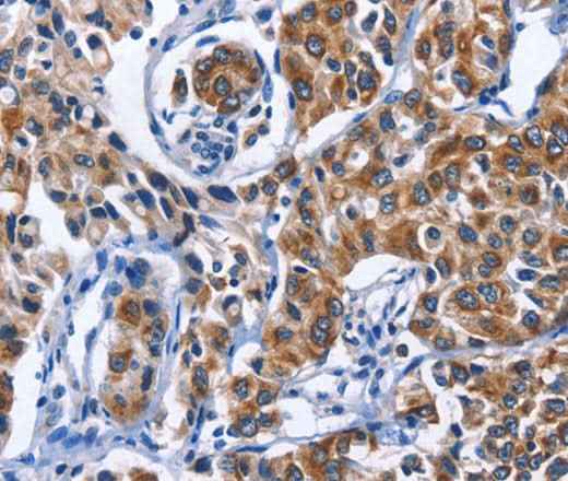 Anti-Human/Mouse MYH1 Antibody