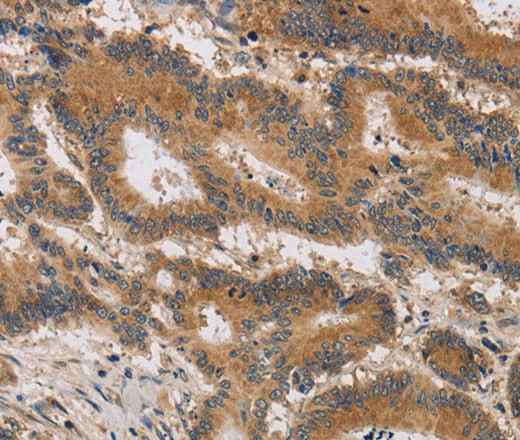 Anti-Human/Mouse ITIH1 Antibody
