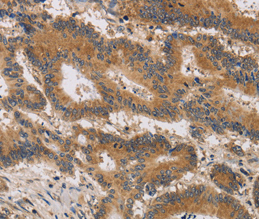 Anti-Human/Mouse ITIH1 Antibody - ABMIUM