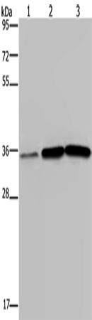 Anti-Human MAGEA3 Antibody - ABMIUM