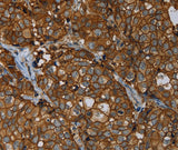 Anti-Human/Mouse/Rat ERBB4 Antibody - ABMIUM