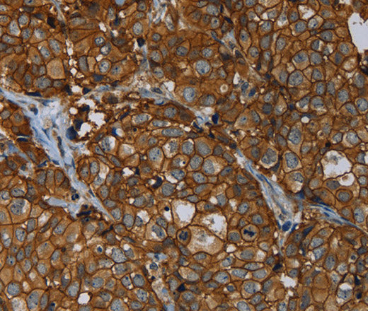 Anti-Human/Mouse/Rat ERBB4 Antibody - ABMIUM