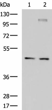 Western blot analysis of Jurkat and TM4 cell lysates using DNAJA4 Polyclonal Antibody at dilution of 1:650