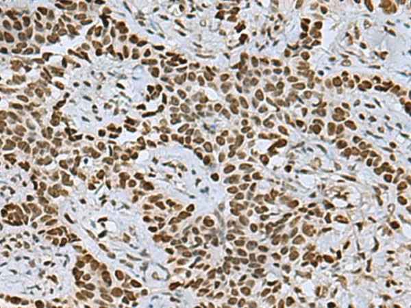 Anti-Human MYEF2 Antibody