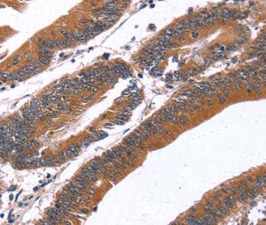 Anti-Human/Mouse GREB1 Antibody