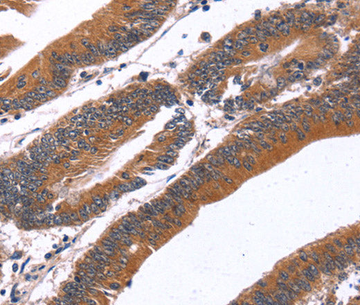 Anti-Human/Mouse GREB1 Antibody - ABMIUM