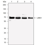Anti-Human LIMK1 Antibody [A762] - ABMIUM
