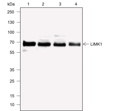 Anti-Human LIMK1 Antibody [A762] - ABMIUM