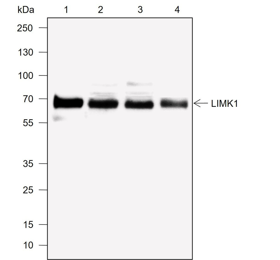 Anti-Human LIMK1 Antibody [A762] - ABMIUM
