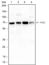 Anti-Human/Rat/Mouse PCK2 Antibody [A324]