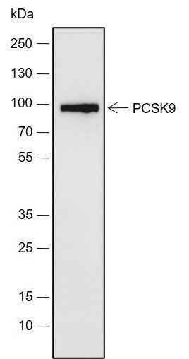Anti-Human/Rat/Mouse PCSK9 Antibody [A674]