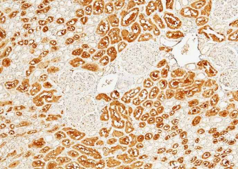 Anti-Human HAGH Antibody [A911] - ABMIUM
