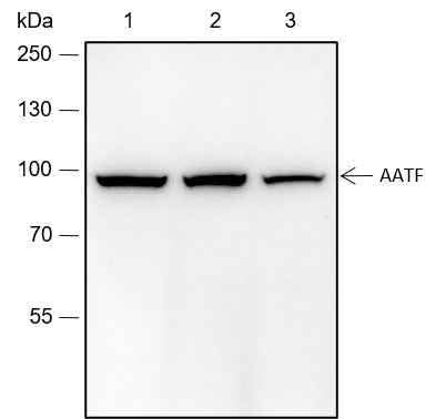 Anti-Human AATF Antibody [A118] - ABMIUM