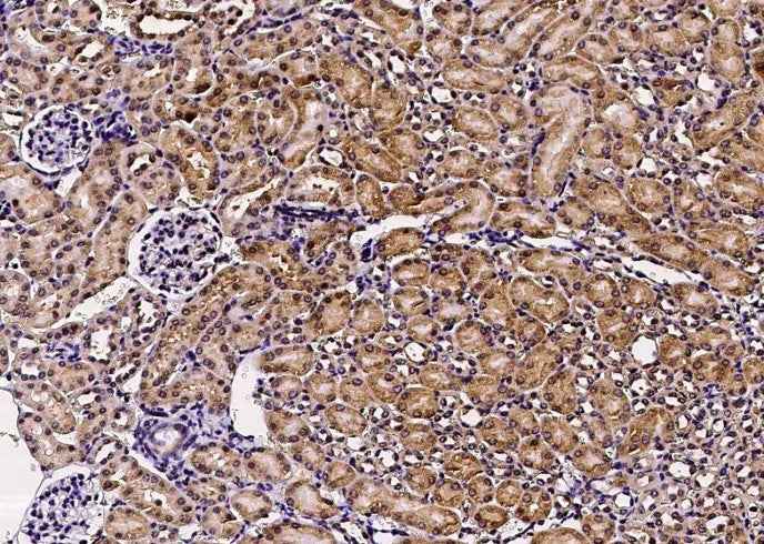 Anti-Mouse GFRA1 Antibody [B418] - ABMIUM
