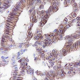 Anti-Human/Rat/Mouse Cadherin-17 Antibody [A111]
