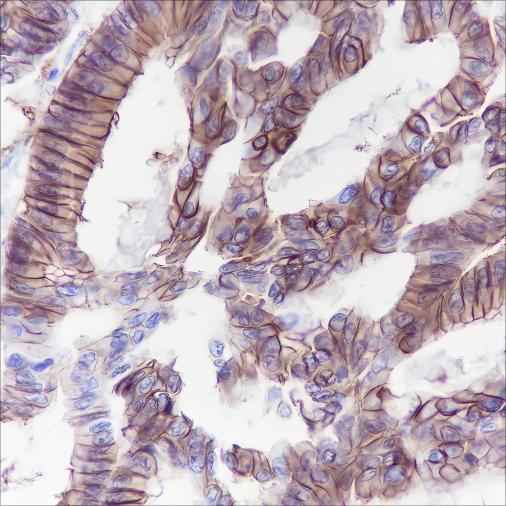 Anti-Human/Rat/Mouse Cadherin-17 Antibody [A111] - ABMIUM