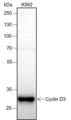Anti-Human Cyclin D3 Antibody [A203] - ABMIUM