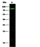 Anti-Human MMP2 Antibody [A1226] - ABMIUM