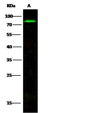 Anti-Human MMP2 Antibody [A1226] - ABMIUM