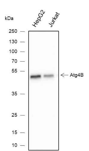 Anti-Human/Mouse ATG4B Antibody [A343] - ABMIUM