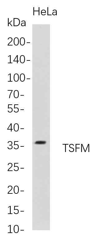 Anti-Human TSFM Antibody [B716] - ABMIUM