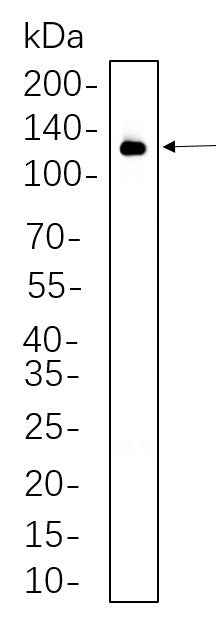 Anti-Human/Mouse/Rat VCAM1 Antibody [B563] - ABMIUM