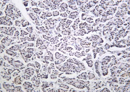 Anti-Human/Mouse/Rat Cdk9 Antibody [B1039] - ABMIUM