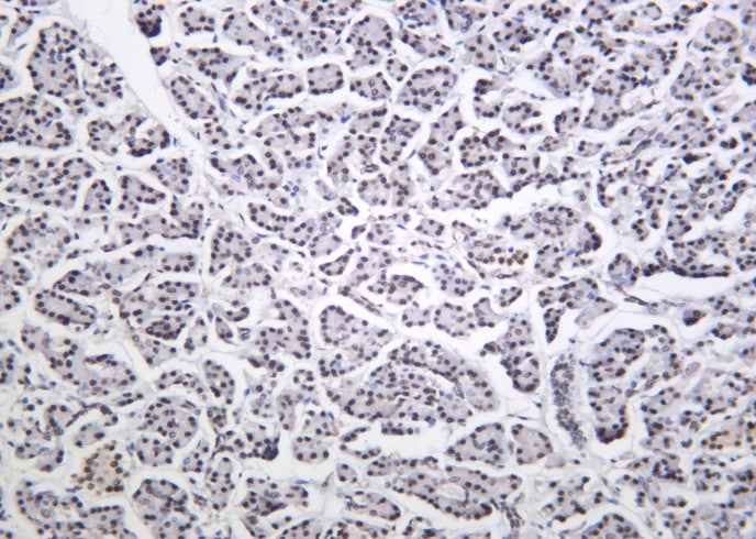 Anti-Human/Mouse/Rat Cdk9 Antibody [B1039]